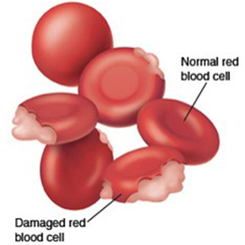 Red blood cells being categorized as damaged red blood cells and normal red blood cells.